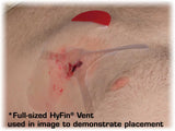 Hyfin Vent Compact Chest Seal Twin Pack, 10-0042, North American Rescue